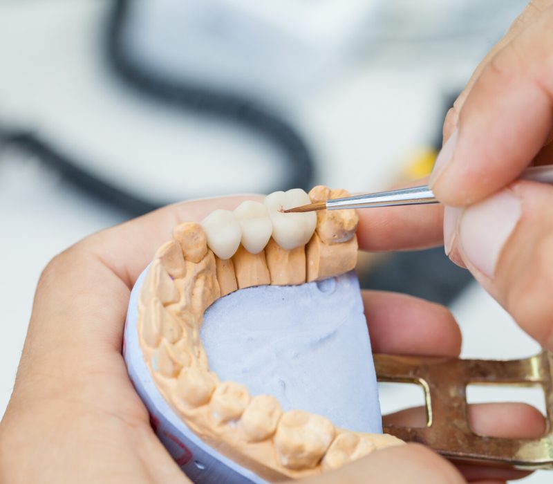 dental technician works by brush with jaw model