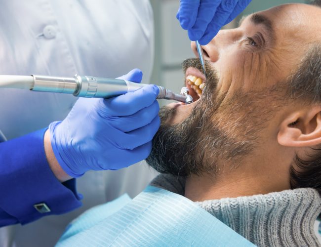 Dentist cleaning teeth. Hands of stomatologist with tools. Dental health services.