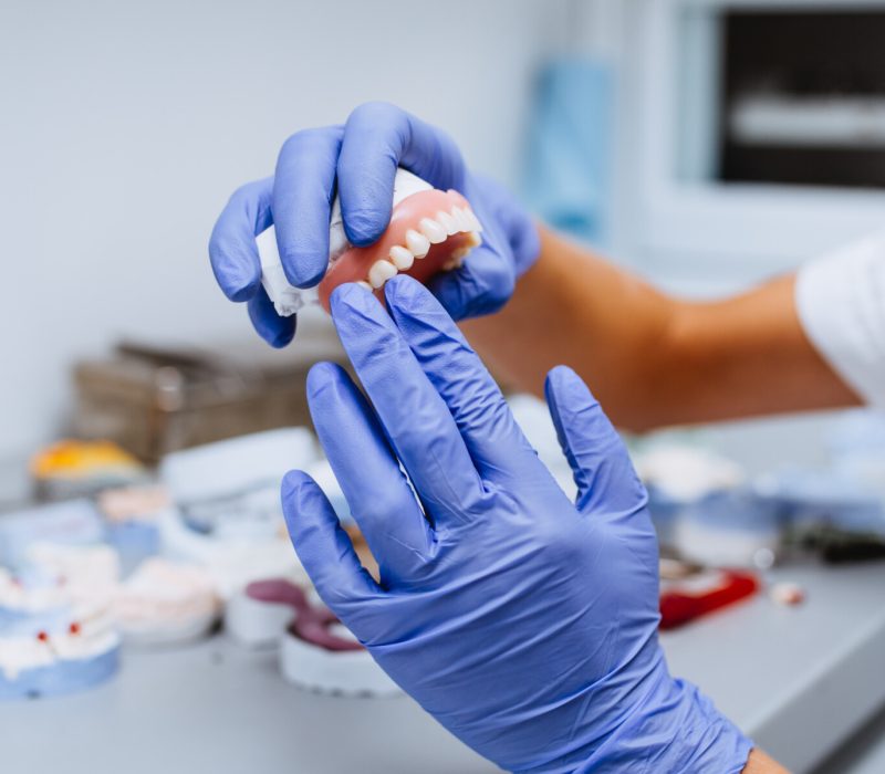 Dental prosthesis, prosthetics work. Close up of prosthetic's hands while working on the denture. Selective focus.