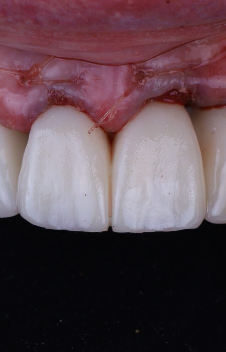 dental reconstruction