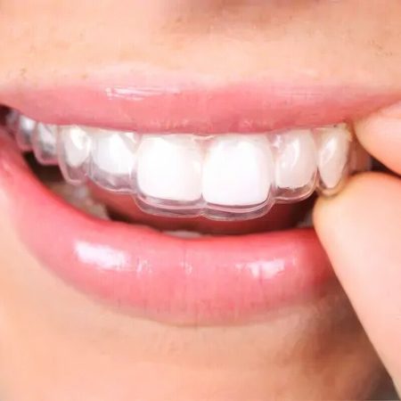 invisalign