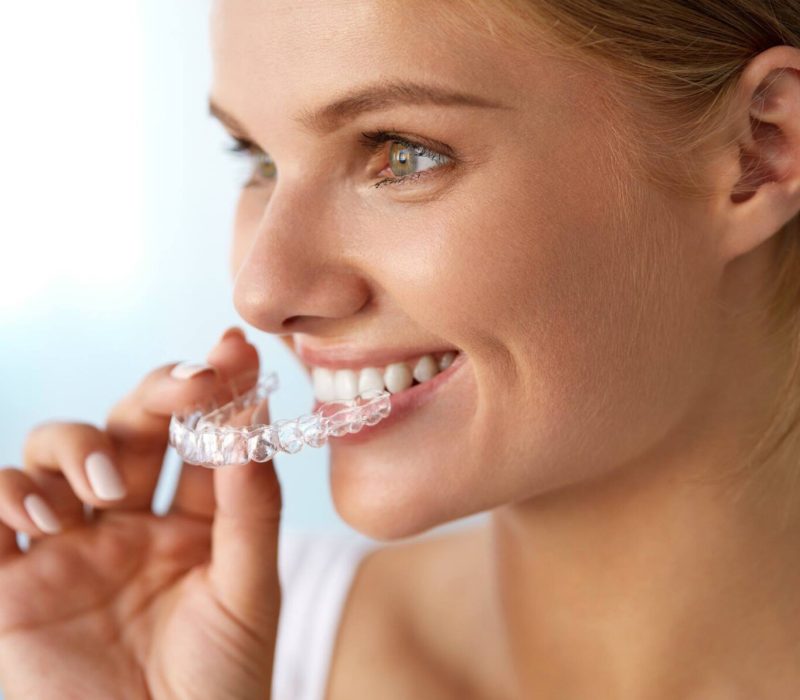 invisalign